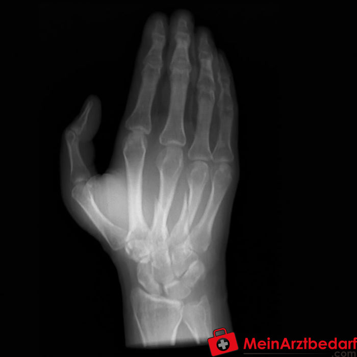 Erler Zimmer Fantom ręki do tomografii komputerowej, rentgenowskiej i radioterapii