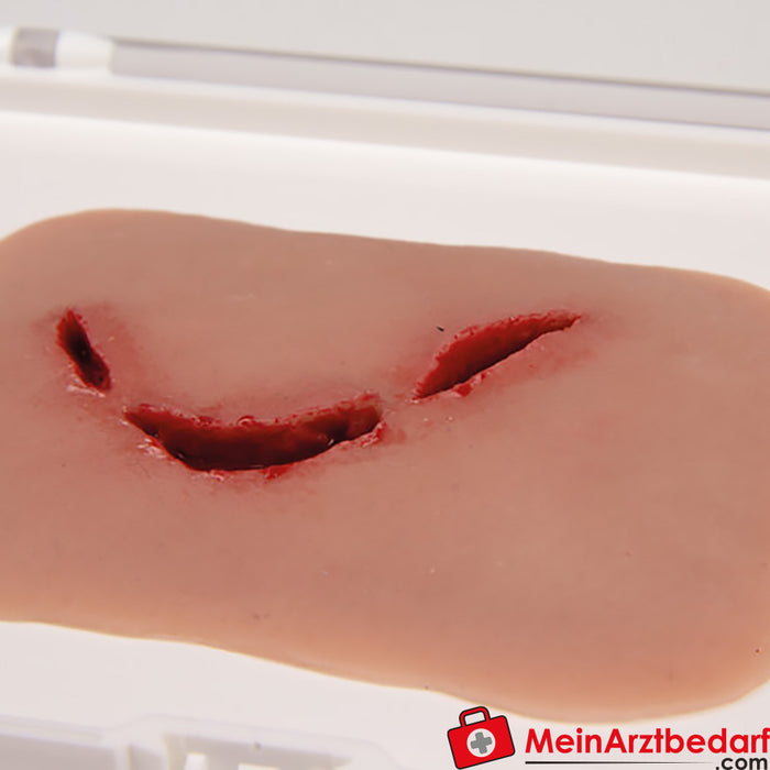 Erler Zimmer Wound Moulage