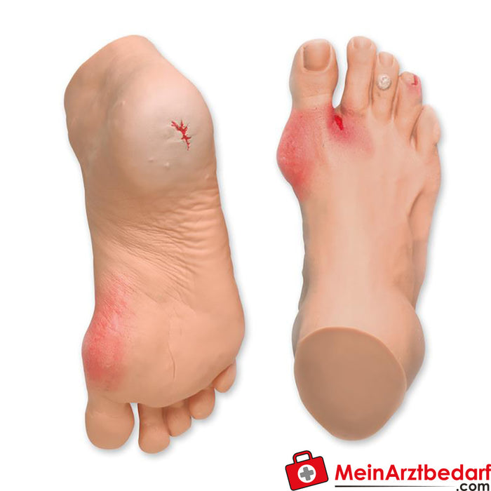 Erler Zimmer Common foot problems