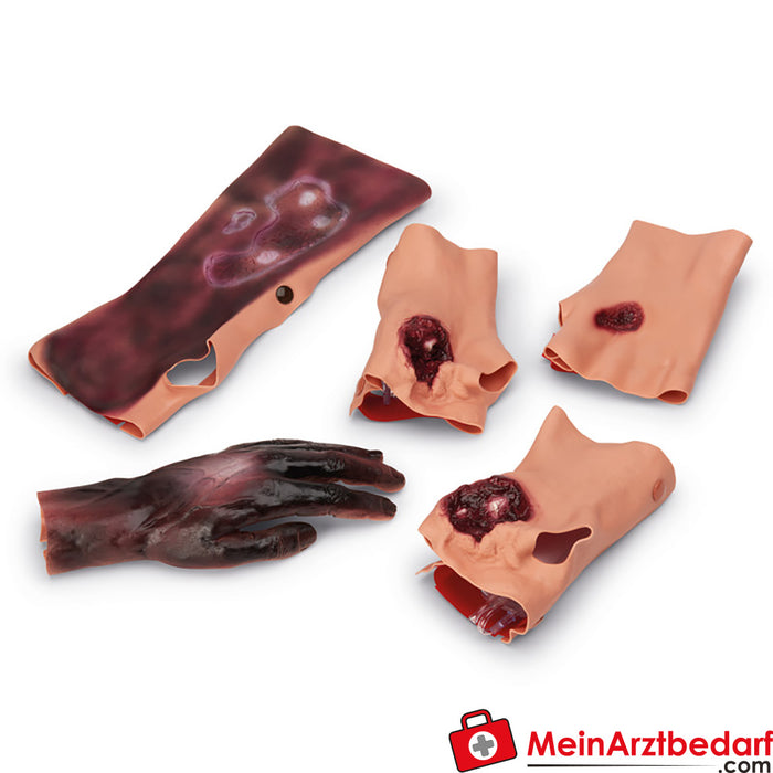 Erler Zimmer Wound simulation