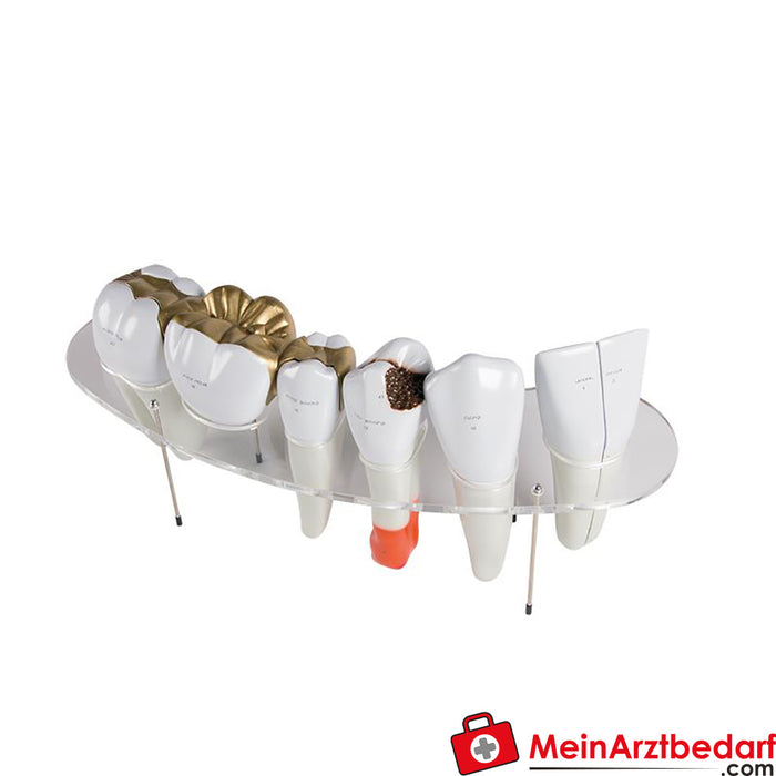 Erler Zimmer Modelo de dentadura postiza, 7 piezas, tamaño de 10 pliegues