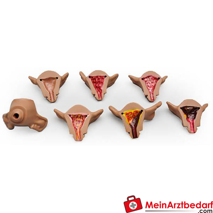 Erler Zimmer Set of seven uteri for R10183