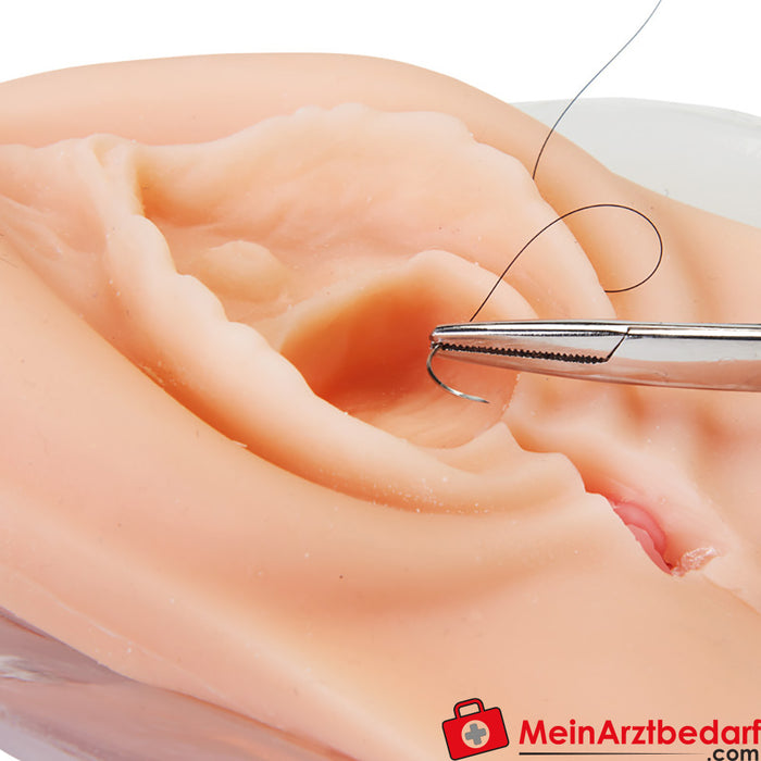 Erler Zimmer Perineale incisie en perineale scheur - Hechtingstrainer
