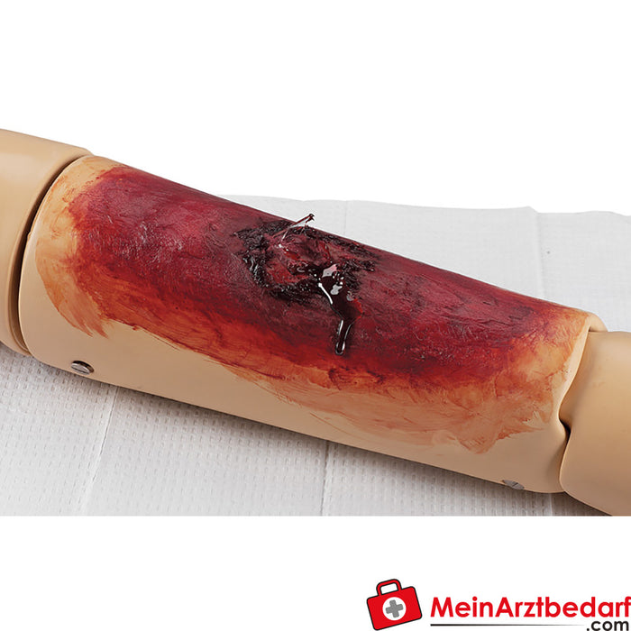 Erler Zimmer Kit de simulação de feridas de enfermagem Ultra