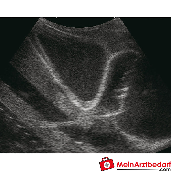 Erler Zimmer Pericardiocentesis simulator with ultrasound support