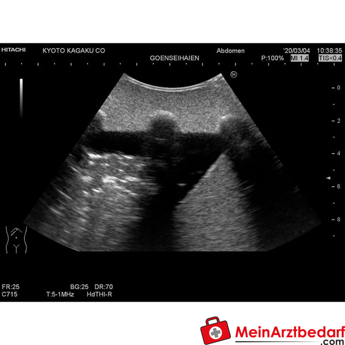 Fantoma de entrenamiento para ultrasonido pulmonar Erler Zimmer