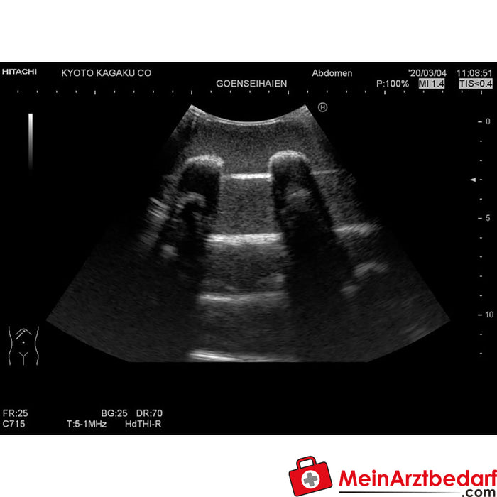 Fantoma de entrenamiento para ultrasonido pulmonar Erler Zimmer