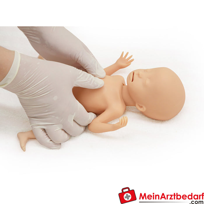 Erler odası Aşırı düşük doğum ağırlıklı (ELBW) preterm bebek