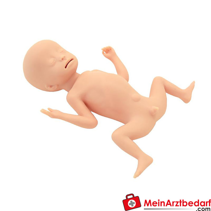Erler Zimmer Bebé prematuro con peso extremadamente bajo al nacer (EBPN)