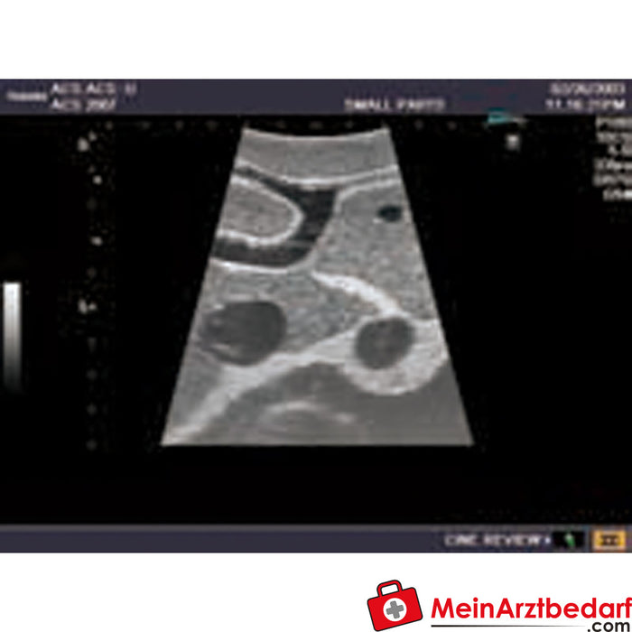 Erler Zimmer Ultraschall-Modell für Sonografie