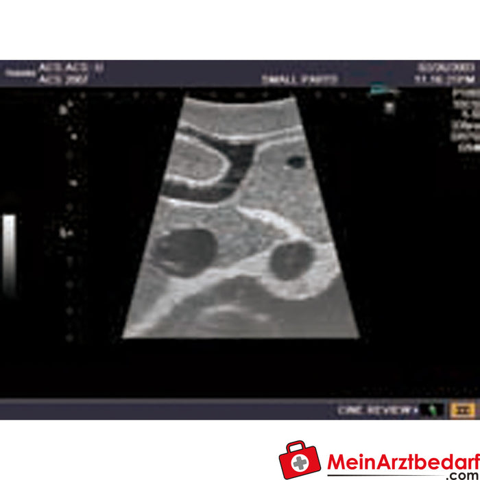 Erler Zimmer Modelo de ultrassom para ultrassonografia