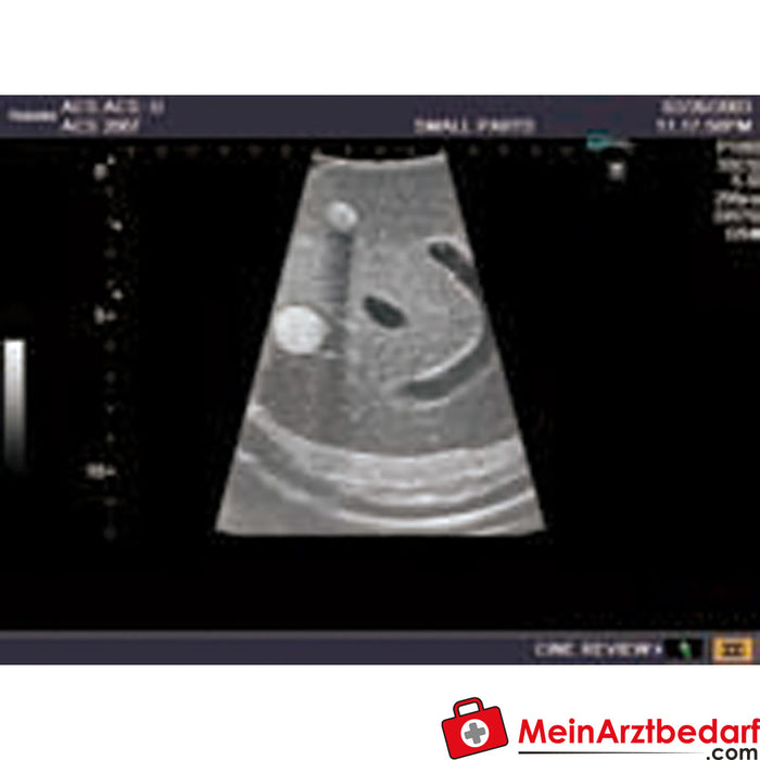 Erler Zimmer Ultraschall-Modell für Sonografie