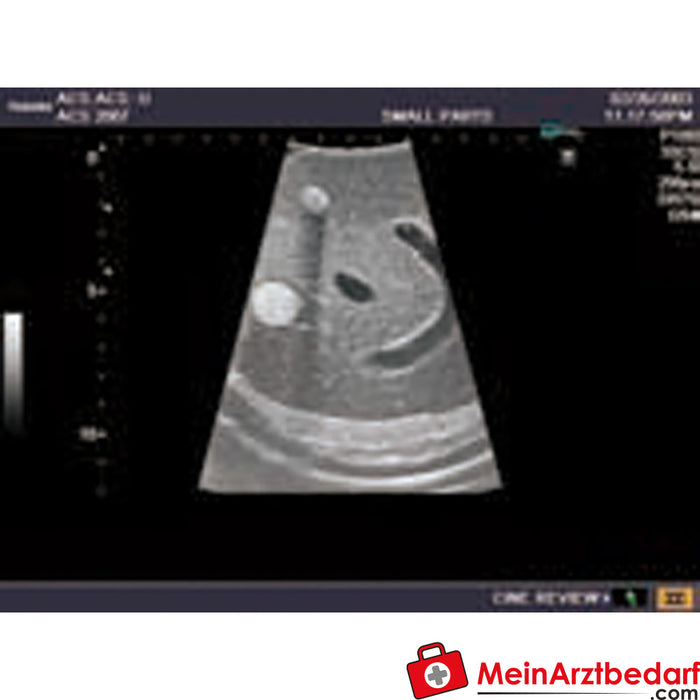 Erler Zimmer Modelo de ultrassom para ultrassonografia