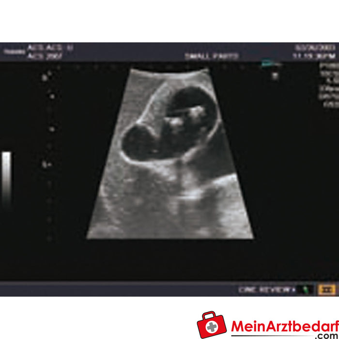 Erler Zimmer Ultraschall-Modell für Sonografie