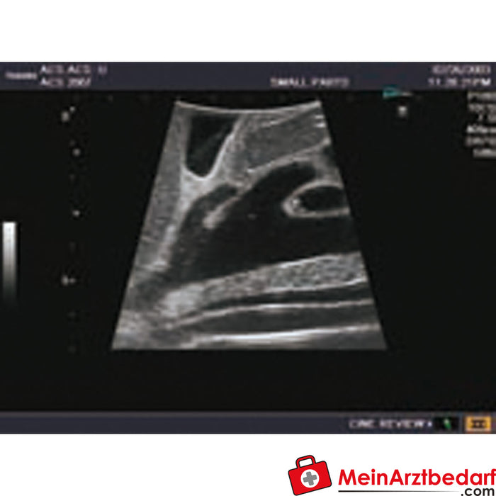 Erler Zimmer Ultraschall-Modell für Sonografie