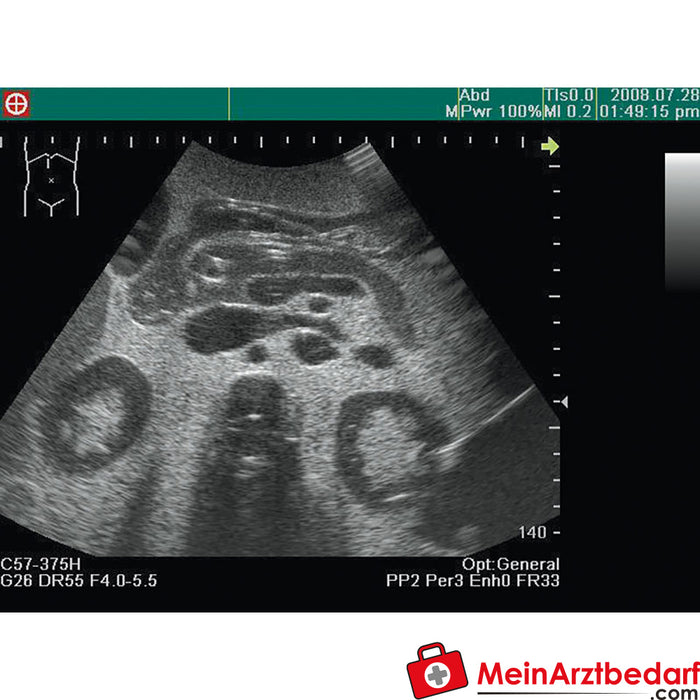 Modelo de formación en ecografía anatomía / patología