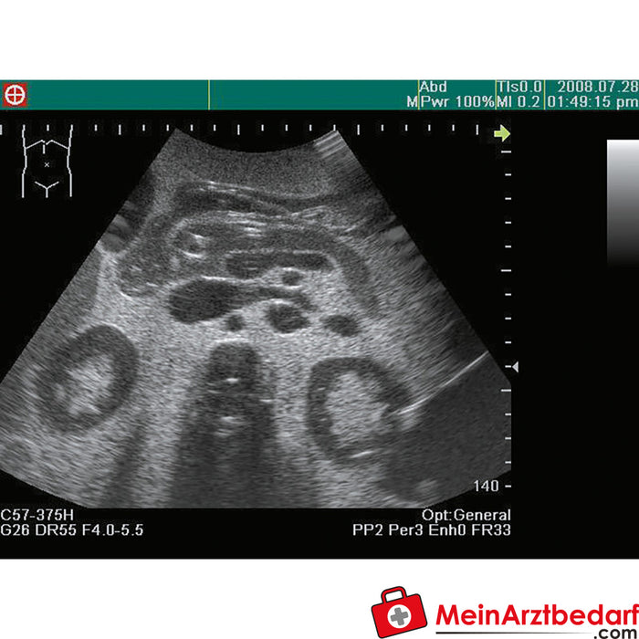 Modelo de formação em ultra-sons anatomia / patologia