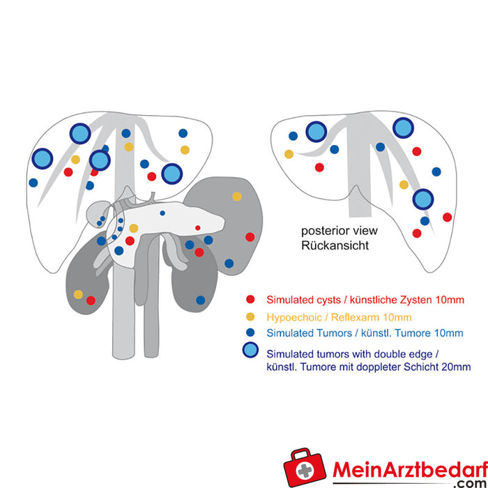 Modello di formazione a ultrasuoni anatomia/patologia