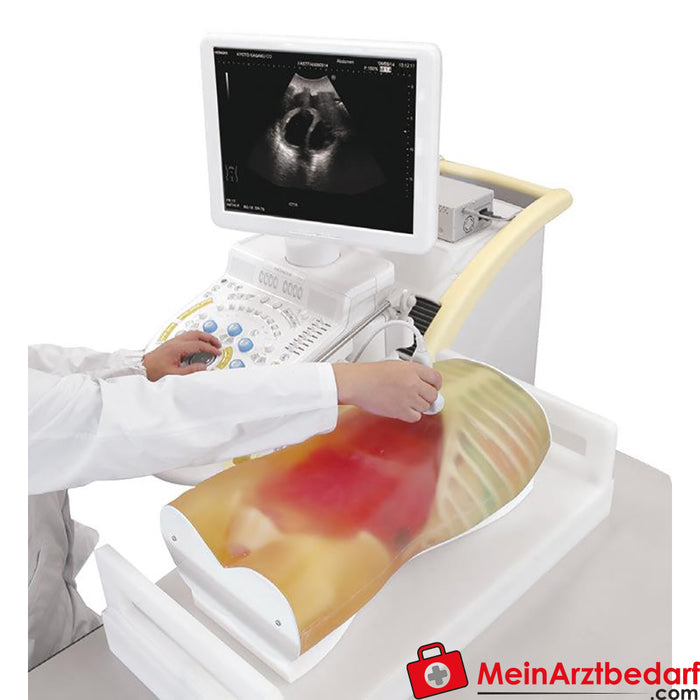 Erler Zimmer FAST ultrasound examination model