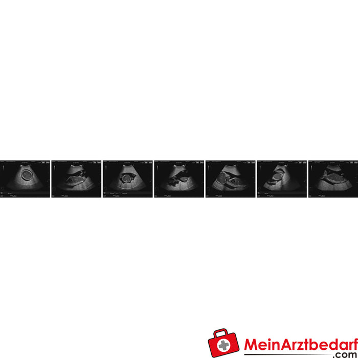 Erler Zimmer Ultrasound examination phantom fetus