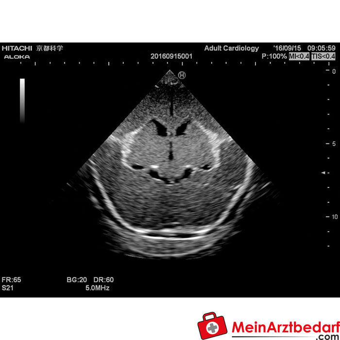 Erler Zimmer Neonatal Ultrasound Training Phantom Head