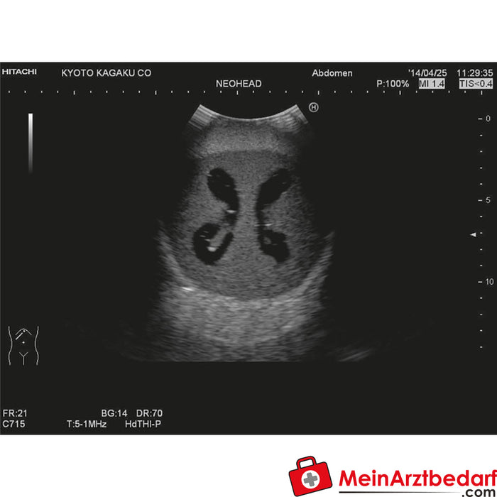 Erler Zimmer Neonatales Ultraschall-Übungsphantom Kopf mit Hydrocephalus