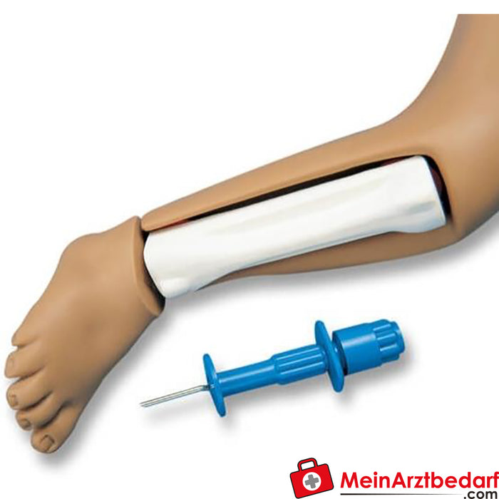 Erler Zimmer Intraosseous leg for R17700