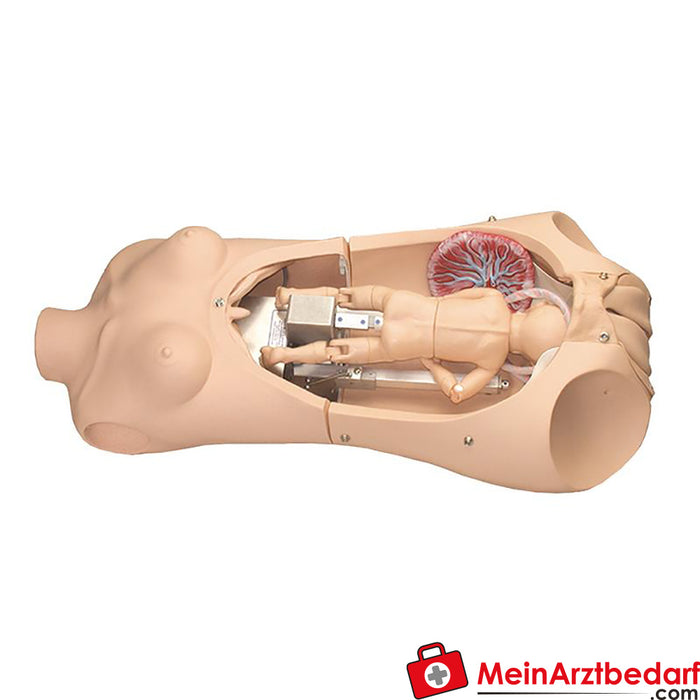 Erler Zimmer Torso de parto de Noelle