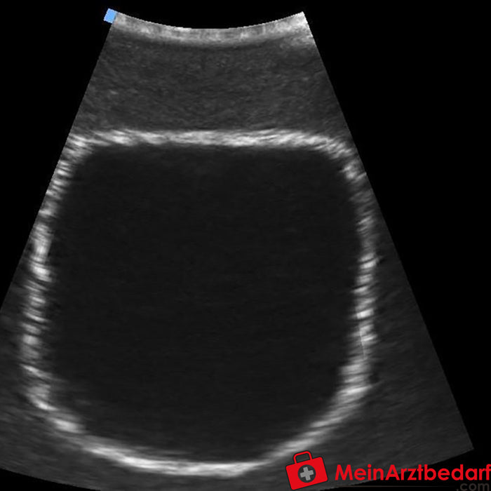 Erler Zimmer Treinador de ultrassom SonoEZ "Bexiga urinária"