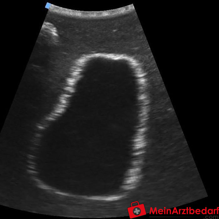 Erler Zimmer SonoEZ Ultrasound Trainer "Pęcherz moczowy