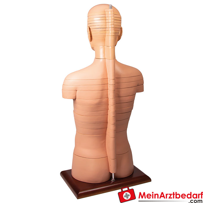 Erler Zimmer Schijf torso, natuurlijke grootte