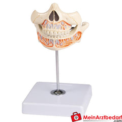 Erler-Zimmer Milchgebiß, 5jährig.