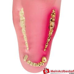 Erler-Zimmer Hundekiefer gesund/erkrankt.