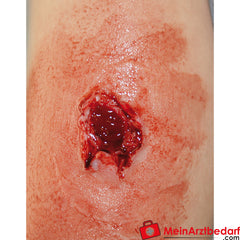Erler-Zimmer EZ Wounds Wundensimulationsset „Professional“.