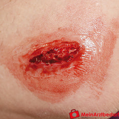 Erler-Zimmer EZ Wounds Wundensimulationsset „Professional“.