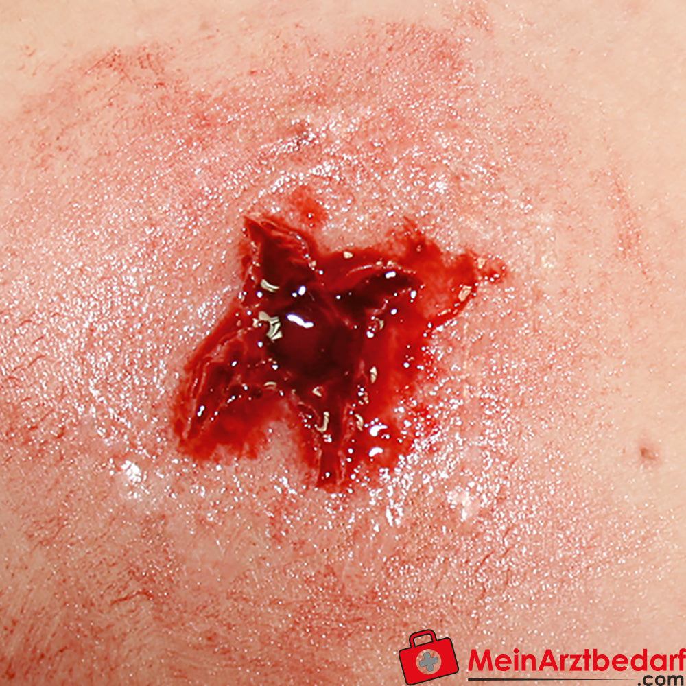 Erler-Zimmer EZ Wounds Wundensimulationsset „Professional“.