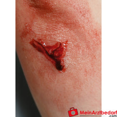 Erler-Zimmer EZ Wounds Wundensimulationsset „Professional“.