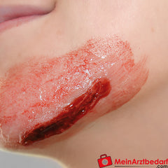 Erler-Zimmer EZ Wounds Wundensimulationsset „Professional“.