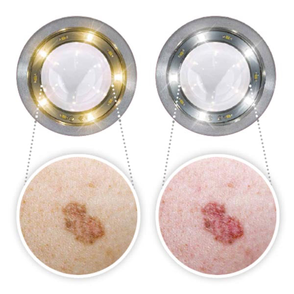 LUXAMED LuxaScope dermatoscoop CCT LED kop, contactschijf ZONDER schaalverdeling